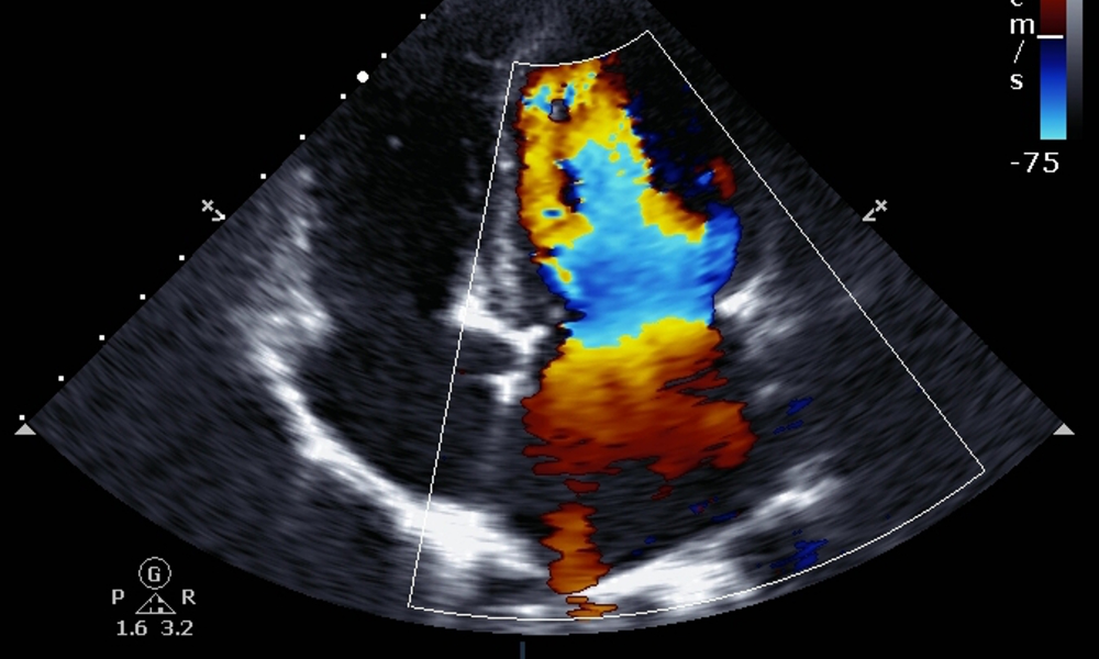 Modern Color Doppler Department