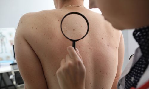 Dermatology Department