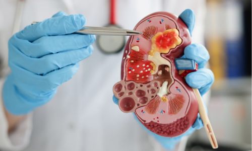 Nephrology Department