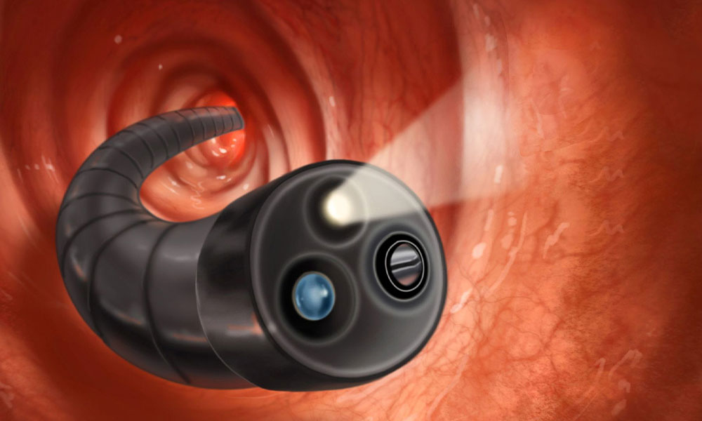 Colonoscopy Department